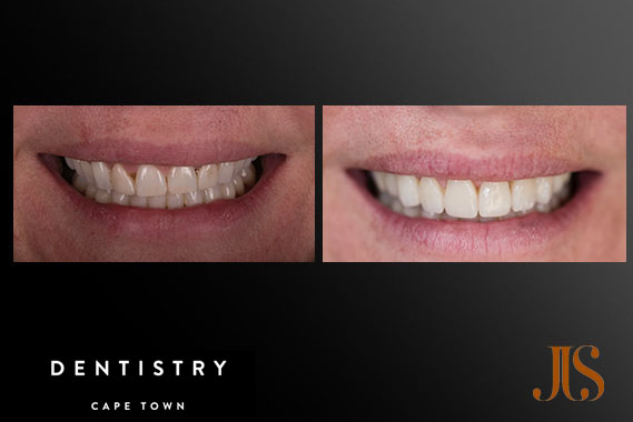 Cosmetic Dentistry