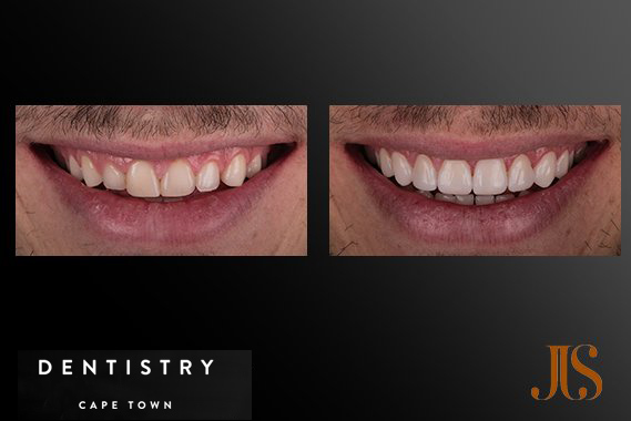 Cosmetic Dentistry Cosmetic Dentistry Cape Town