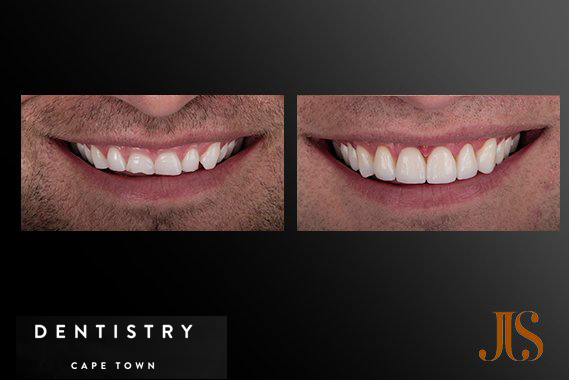 Cosmetic Dentistry Cosmetic Dentistry South Africa