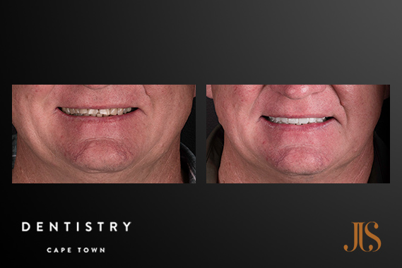 Cosmetic Dentistry Cape Town Cosmetic Dentistry
