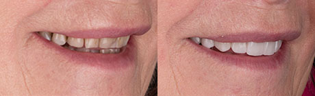 Dental Case 1 | Dentist Cape Town