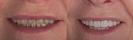 Dental Case 2 | Dentist Cape Town