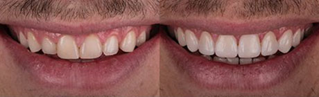 Dental Case 3 | Dentist Cape Town
