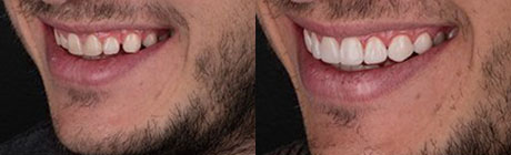 Dental Case 4 | Dentist Cape Town