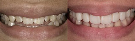Dental Case 5 | Dentist Cape Town