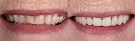 Dental Case 6 | Dentist Cape Town