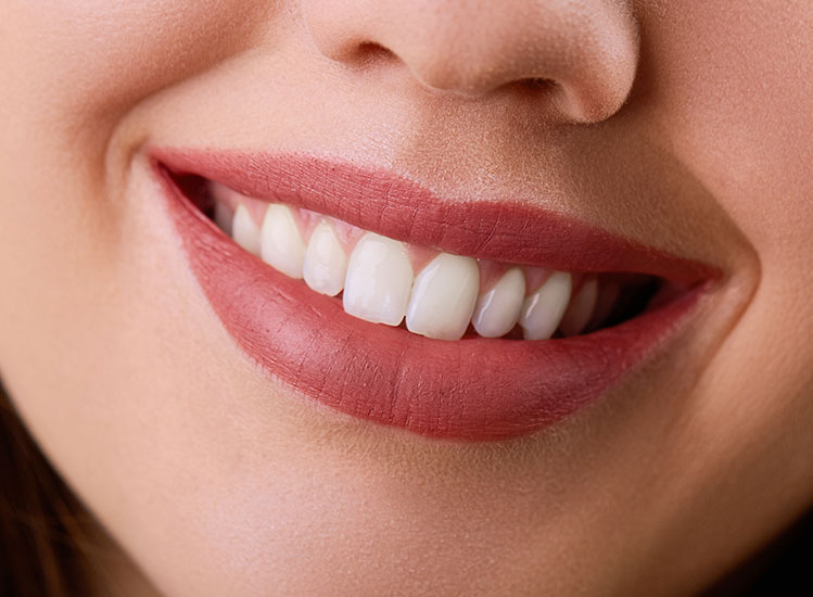 Smile Makeover Cape Town | Dentist Cape Town