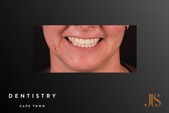 Durbanville Cosmetic Dentsitry Cosmetic Dentistry Durbanville