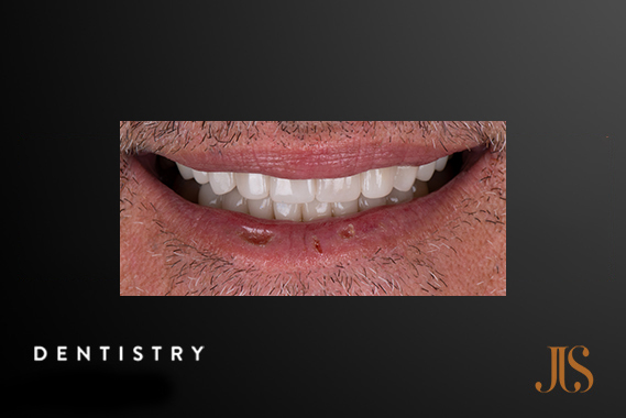 Cosmetic Dentistry Cape Town