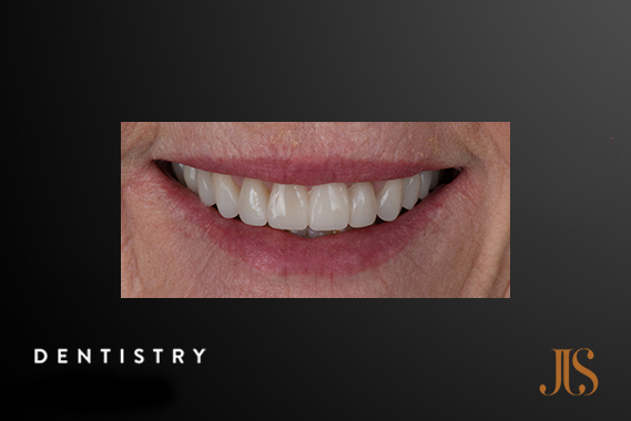 Cosmetic Dentistry Cape Town