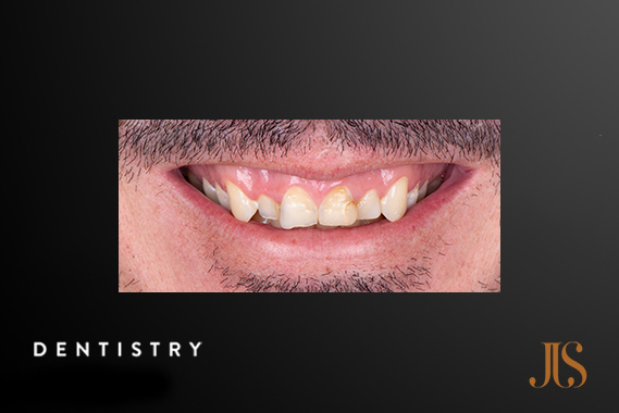 Cosmetic Dentist Cape Town