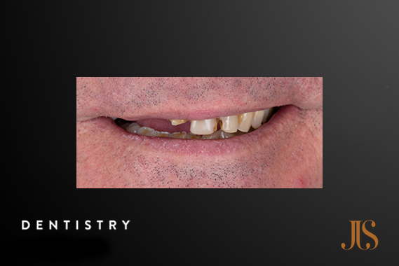 Cosmetic Dentist Cape Town