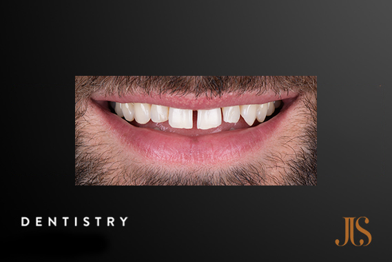 Cosmetic Dentistry Cape Town