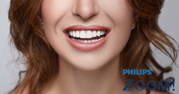 Philips Zoom Whitening