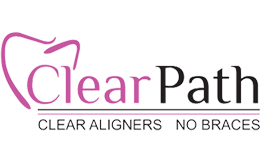 Clear Path Aligners