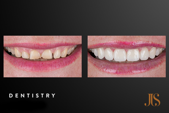 Cosmetic Dentistry