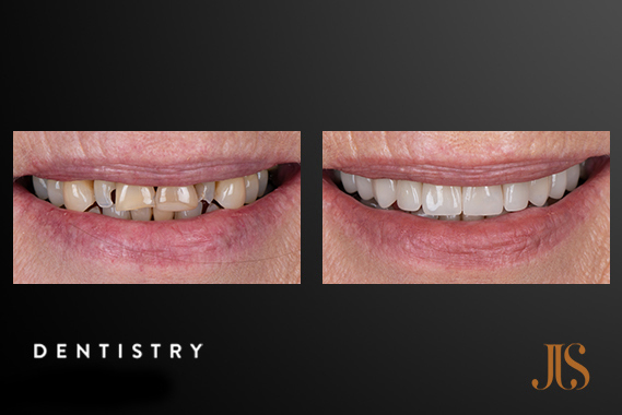 Cosmetic Dentistry