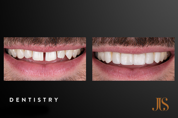 Cosmetic Dentistry