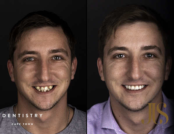 Cape Town Orthodontics | Dr JJ Serfontein