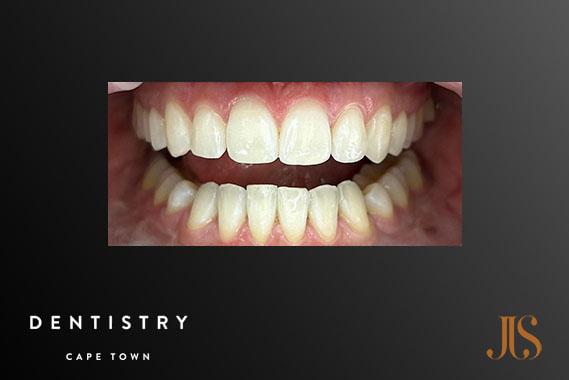 Cosmetic Dentistry Cape Town