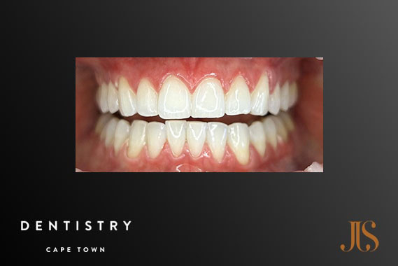 Cosmetic Dentistry Cape Town