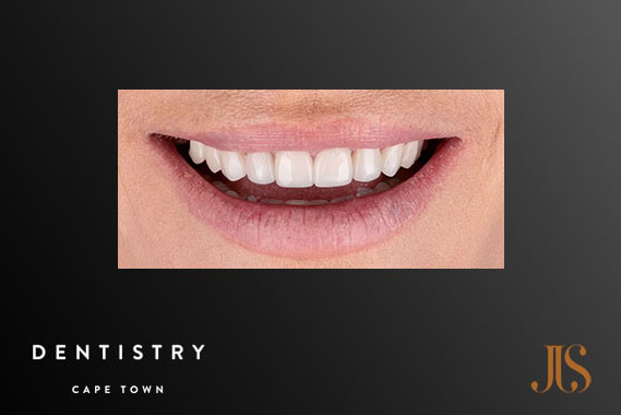 Cosmetic Dentistry Cape Town