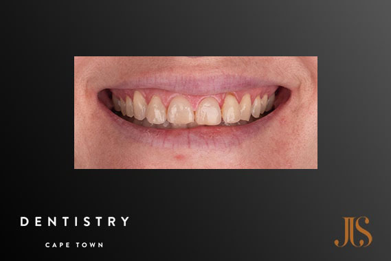 Cosmetic Dentist Cape Town