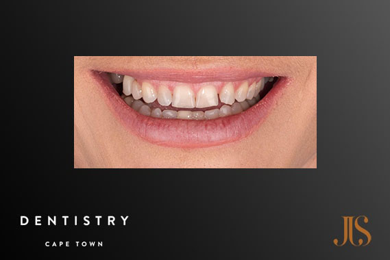 Cosmetic Dentist Cape Town